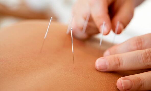 acupuncture to increase activity